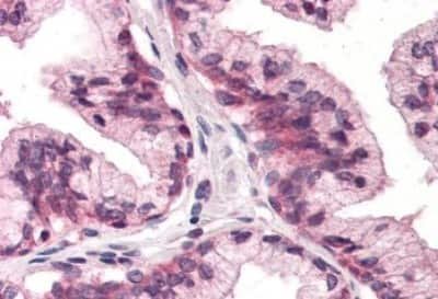 Immunohistochemistry-Paraffin: ATPase Na+/K+ beta 3 Antibody [NBP3-14546] - Immunohistochemistry of formalin-fixed, paraffin-embedded human prostate tissue after heat-induced antigen retrieval.